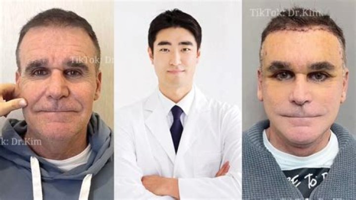 Antonio Garza's Plastic Surgery Journey