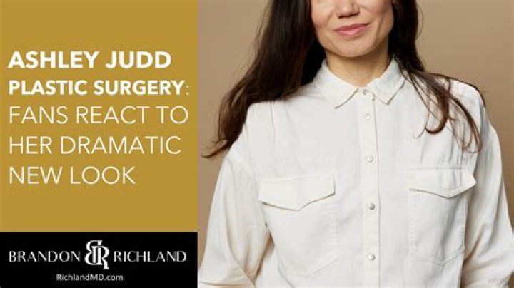 Ashley Judd face: Did Ashley Judd do plastic surgery