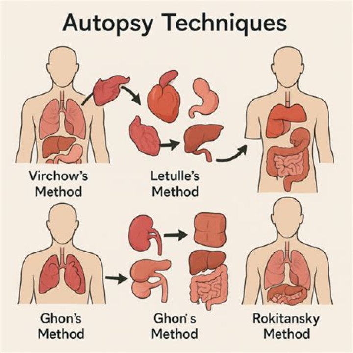 We dont trust Ghana Health authorities, We want an autopsy done in the US American model, Tyg